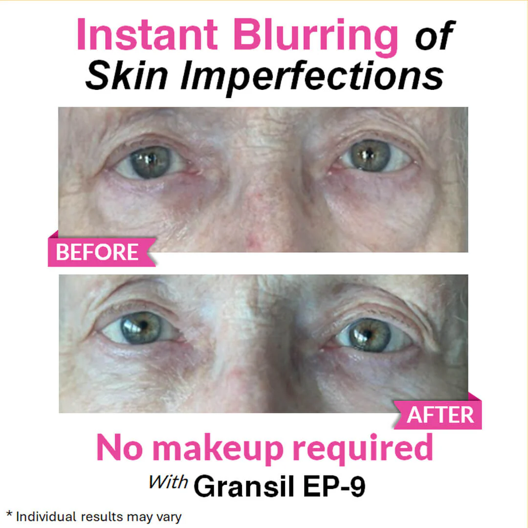Eye Renewal Serum - Image 10
