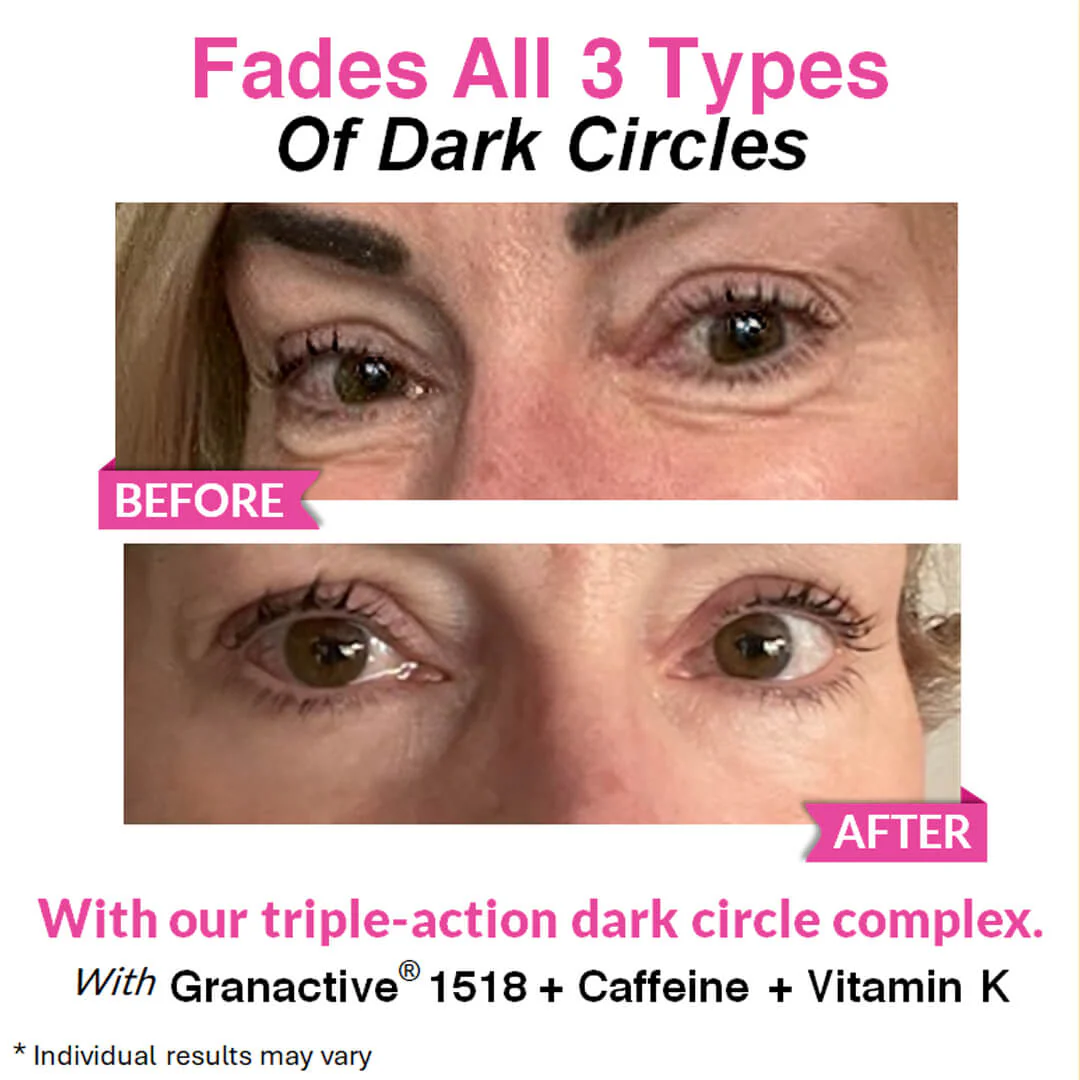 Eye Renewal Serum - Image 11
