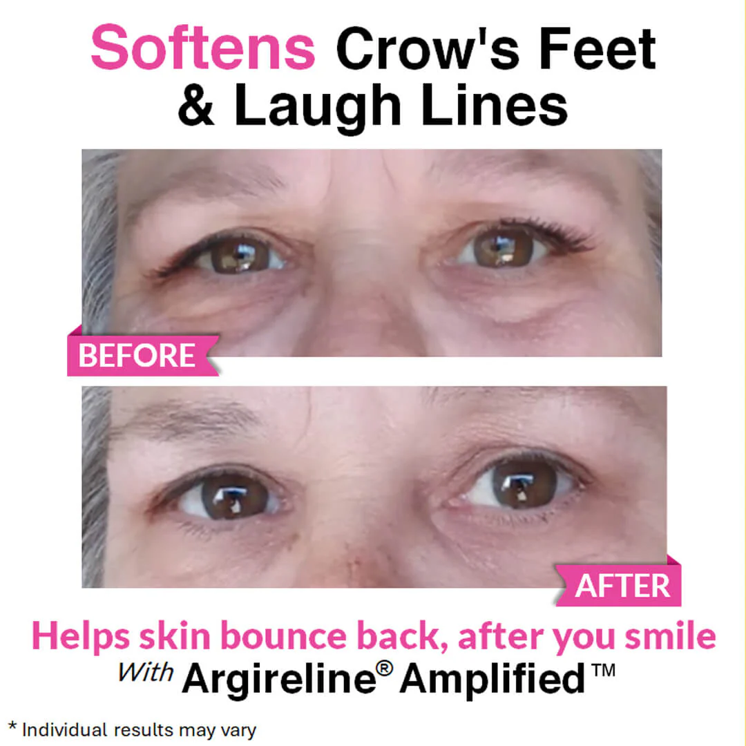 Eye Renewal Serum - Image 7