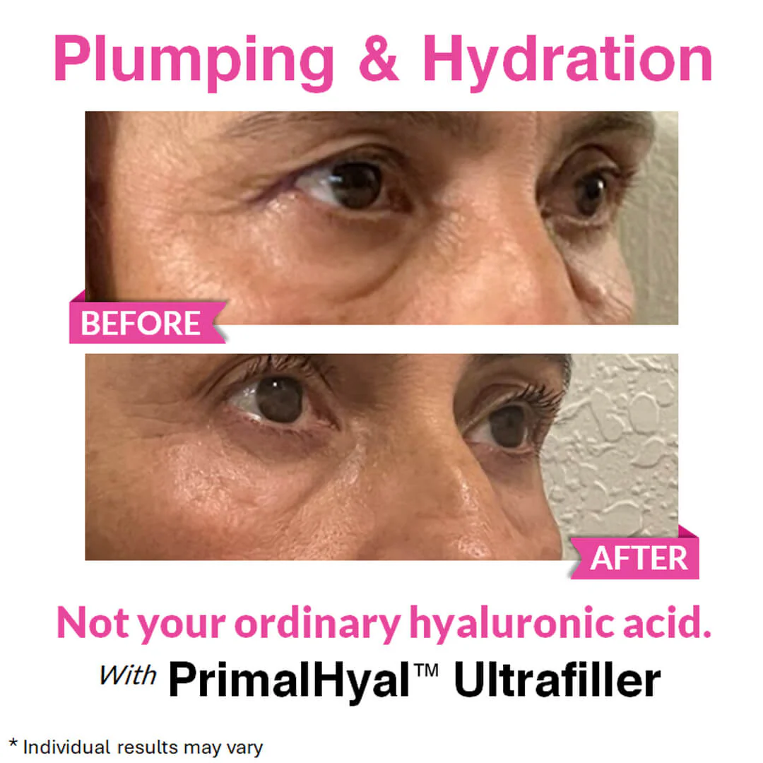 Eye Renewal Serum - Image 8