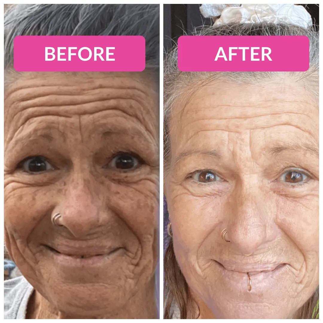 Super C Serum - Image 5
