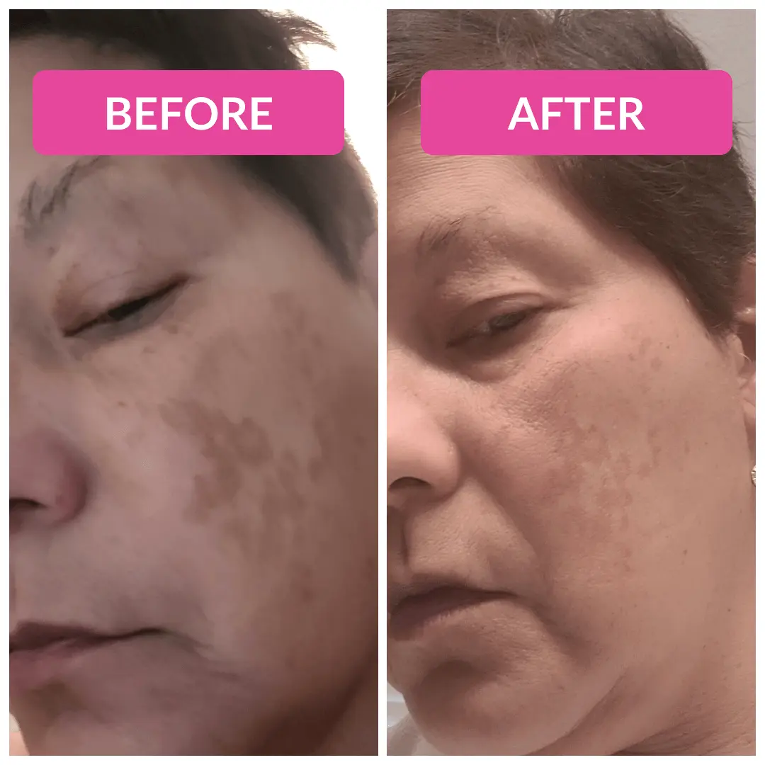 Super C Serum - Image 6