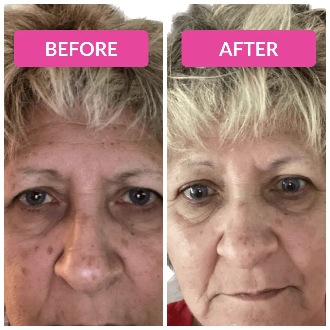 Super C Serum - Image 7