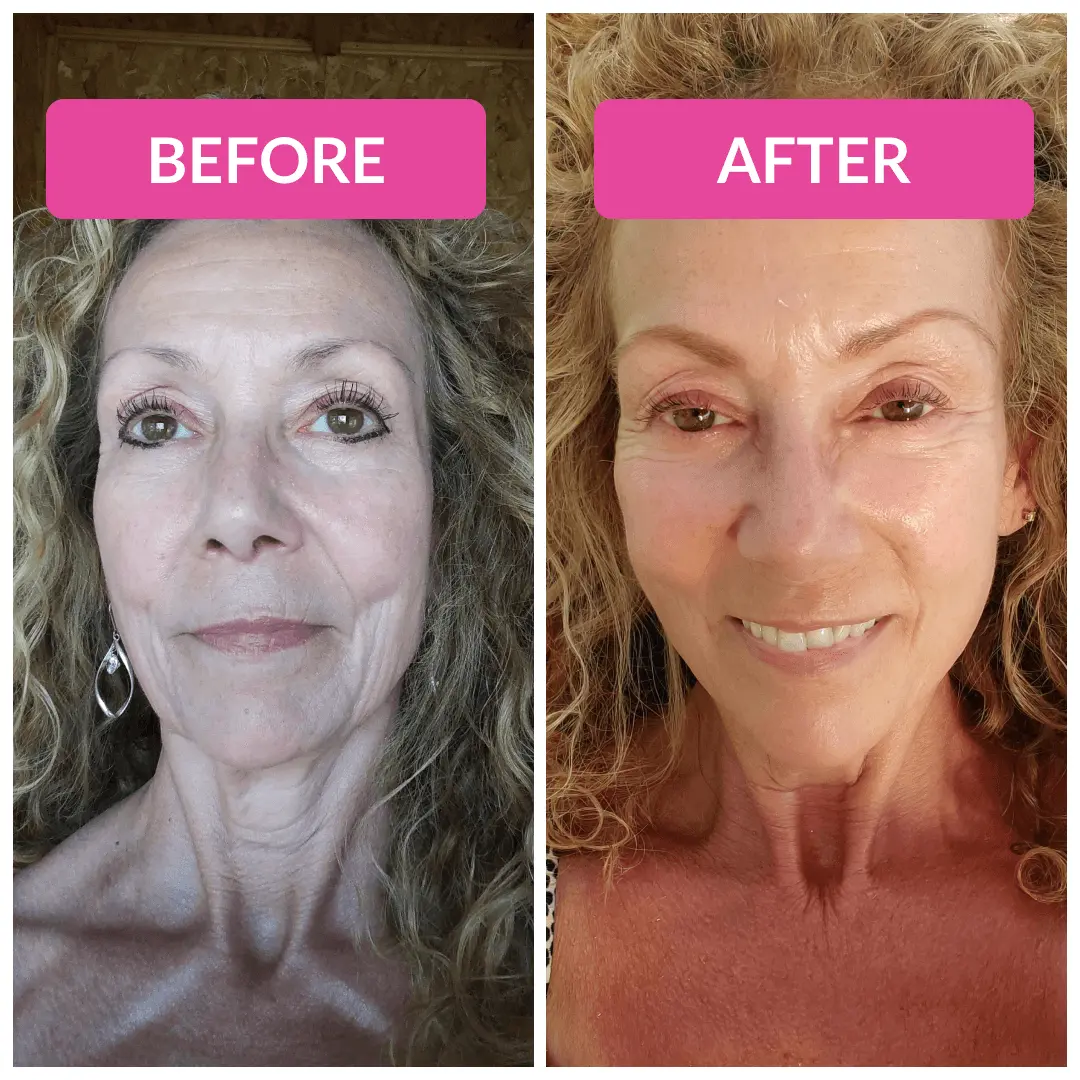 Super C Serum - Image 8